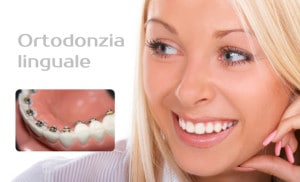 ortodonzia-linguale